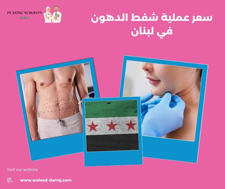 سعر عملية شفط الدهون في لبنان