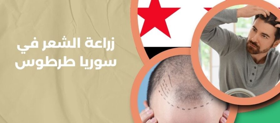 زراعة الشعر في سوريا طرطوس