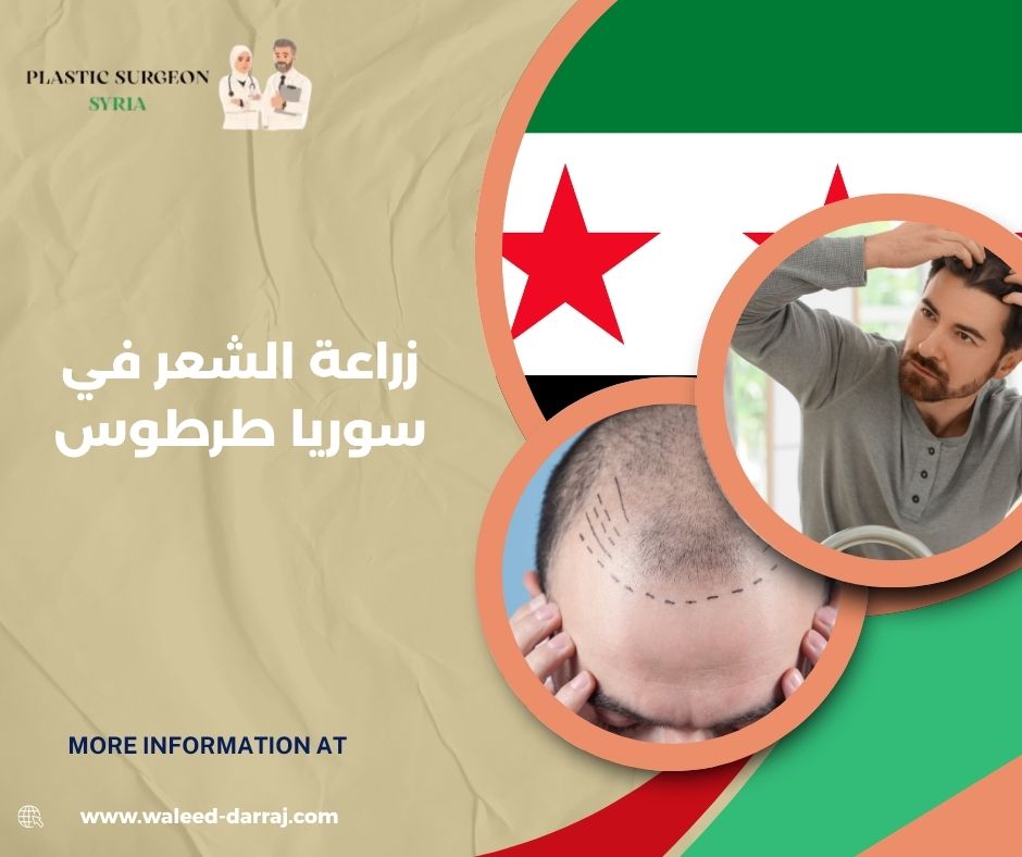 زراعة الشعر في سوريا طرطوس