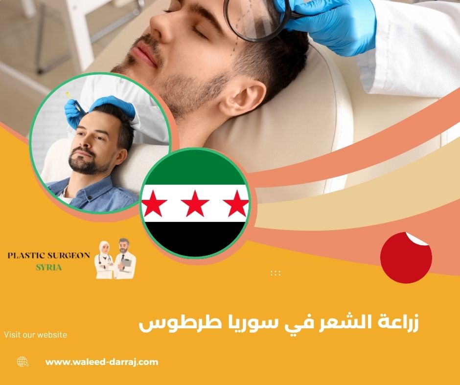 زراعة الشعر في سوريا طرطوس زراعة الشعر في سوريا طرطوس