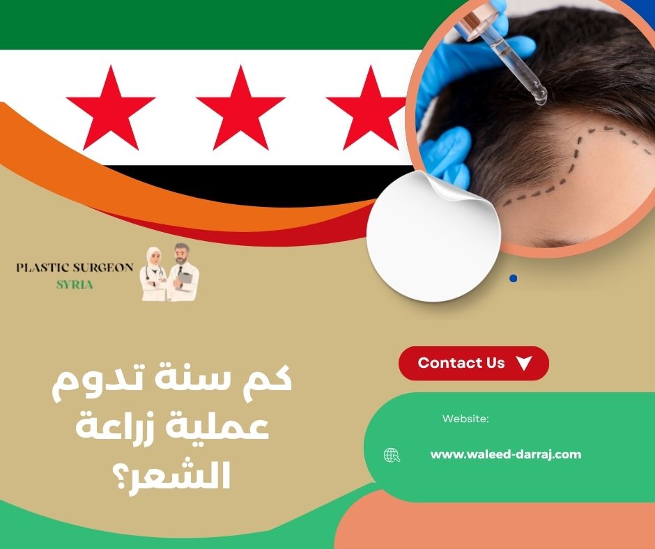 كم سنة تدوم عملية زراعة الشعر؟