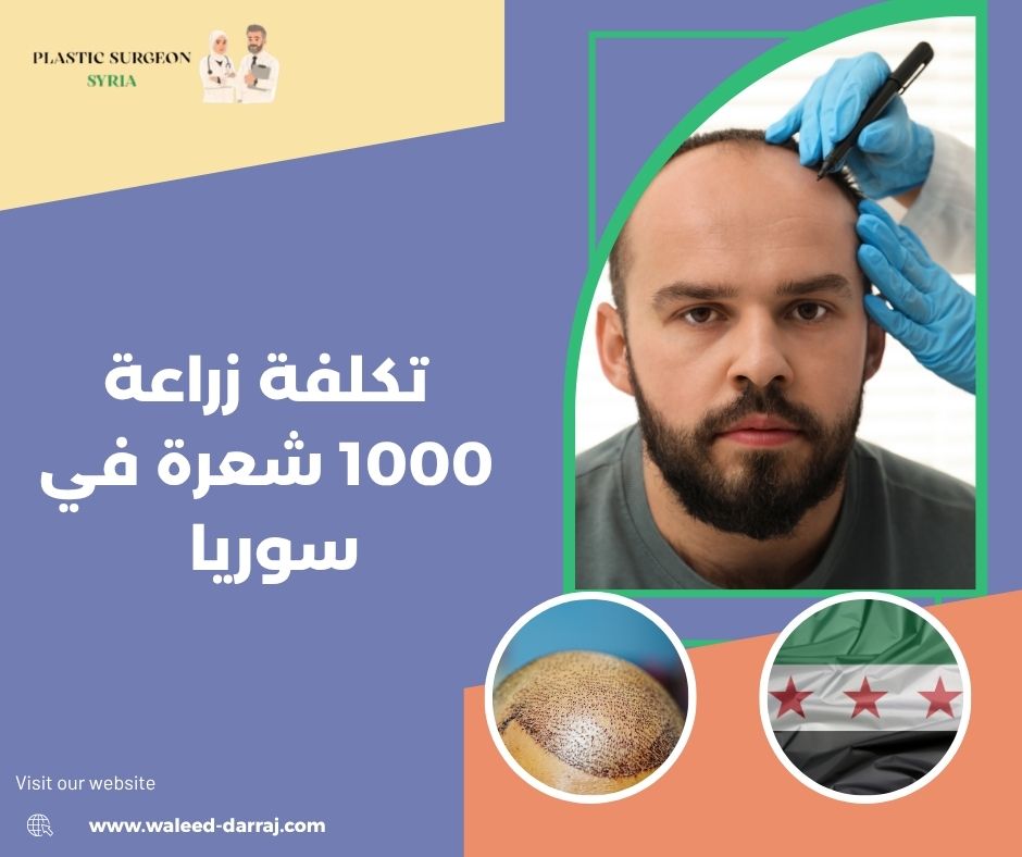 تكلفة زراعة 1000 شعرة في سوريا