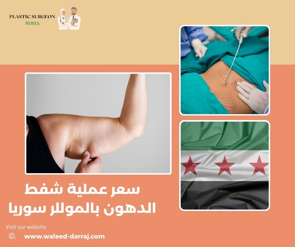 سعر عملية شفط الدهون بالموللر سوريا سعر عملية شفط الدهون بالموللر سوريا