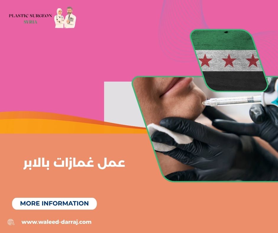 عمل غمازات بالابر عمل غمازات بالابر