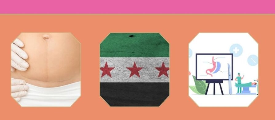 افضل دكتورة قص معدة وتكميم في دمشق