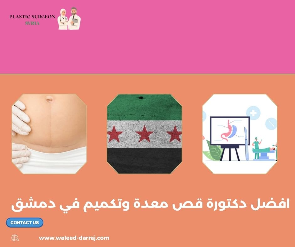 افضل دكتورة قص معدة وتكميم في دمشق