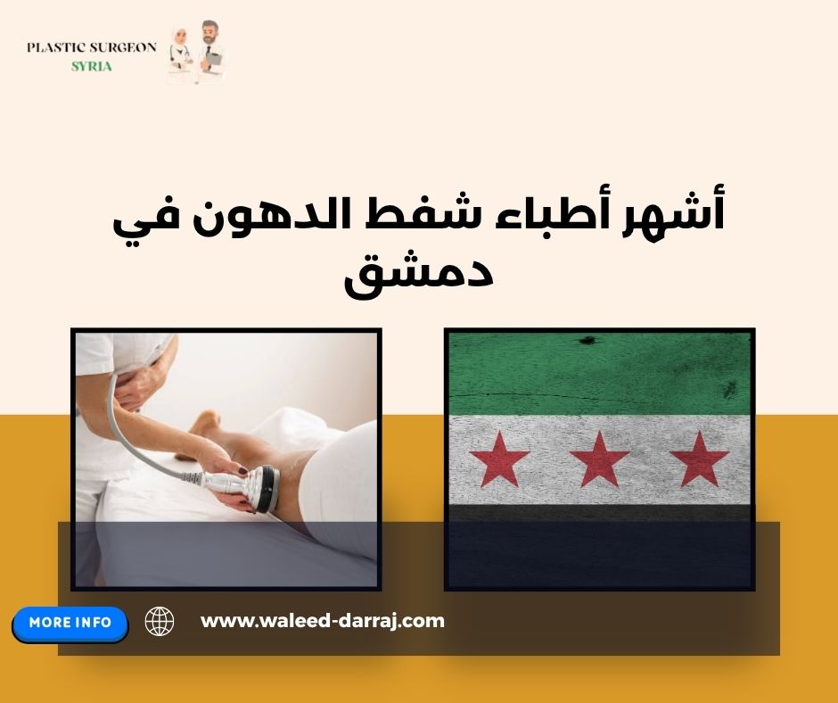 أشهر أطباء شفط الدهون في دمشق