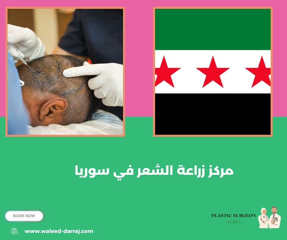 مركز زراعة الشعر في سوريا