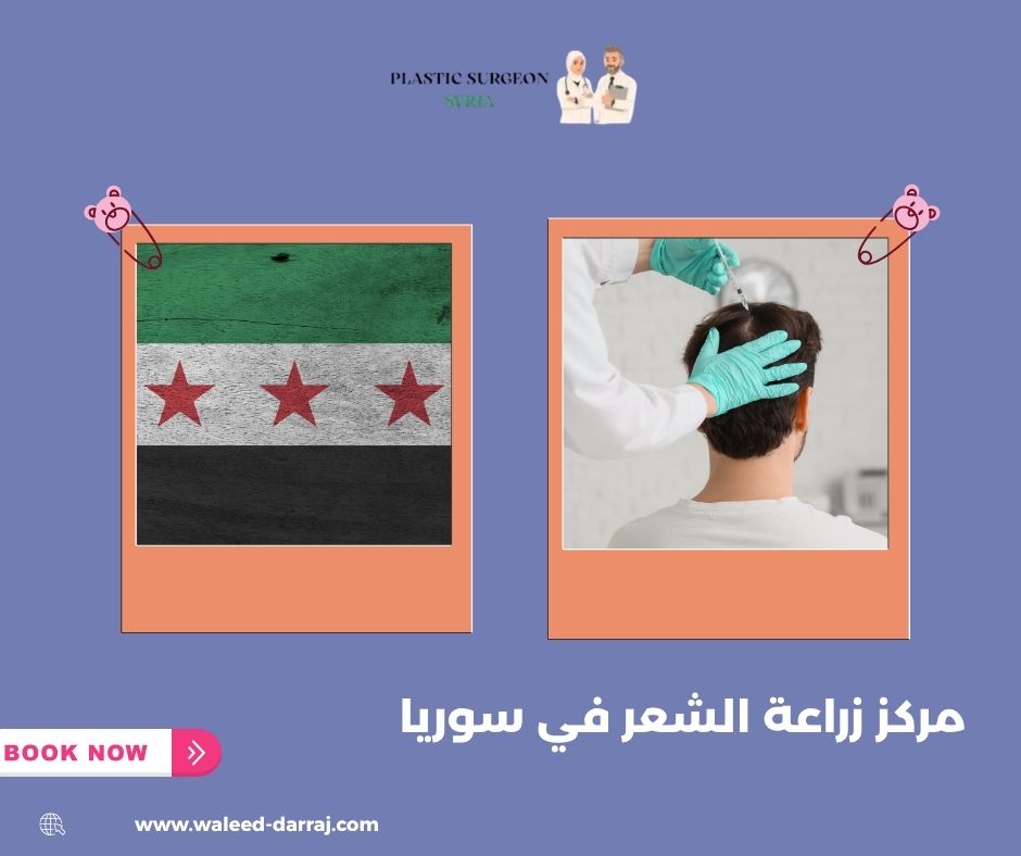مركز زراعة الشعر في سوريا