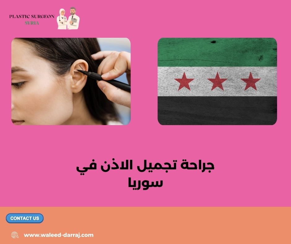 جراحة تجميل الاذن في سوريا