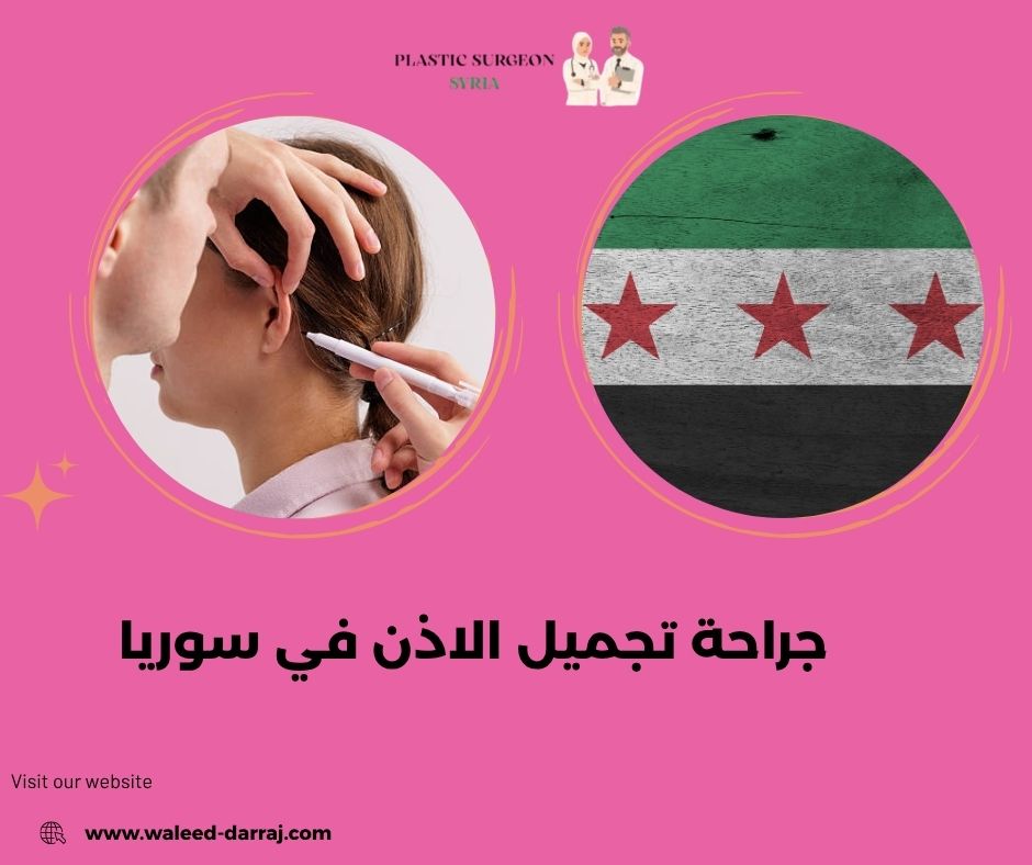 جراحة تجميل الاذن في سوريا