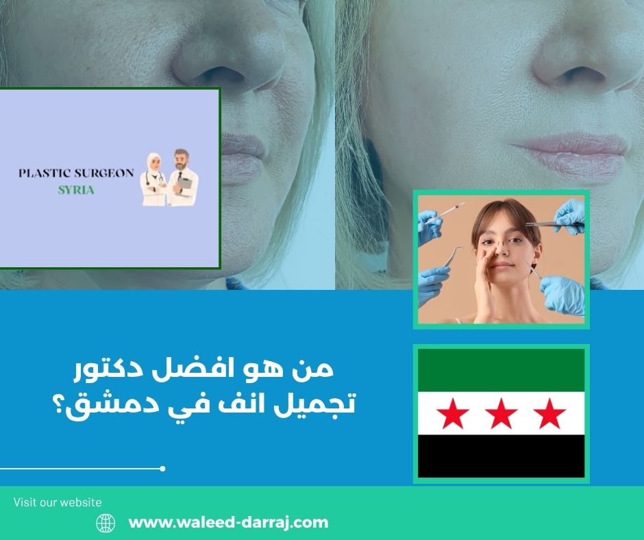 من هو افضل دكتور تجميل انف في دمشق؟