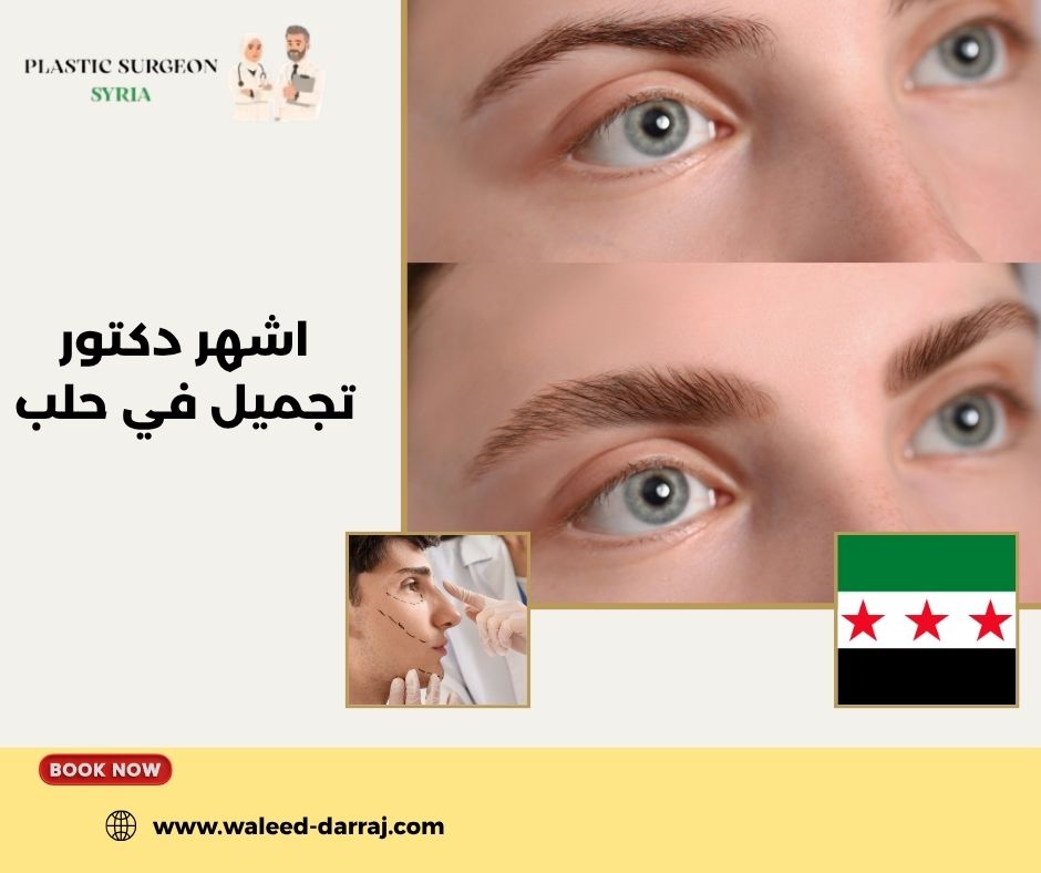 اشهر دكتور تجميل في حلب
