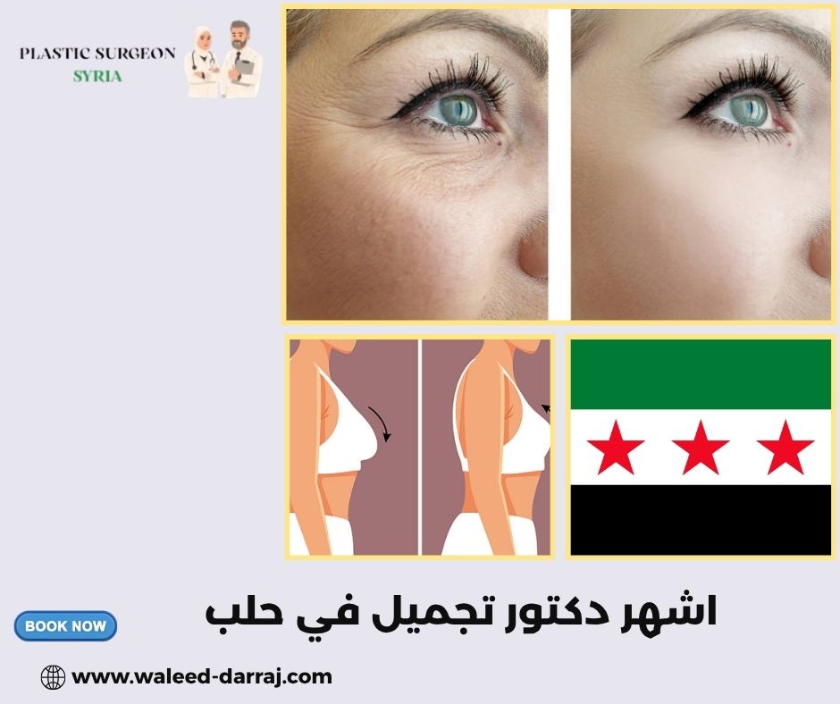 اشهر دكتور تجميل في حلب