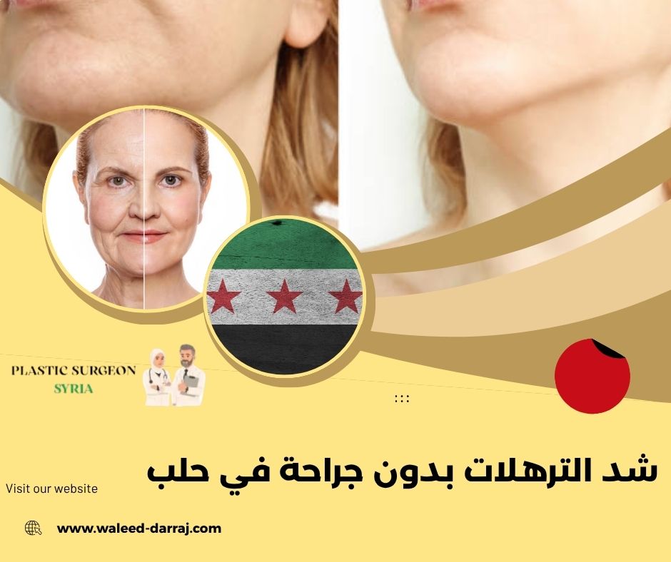 شد الترهلات بدون جراحة في حلب