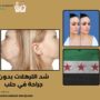 شد الترهلات بدون جراحة في حلب