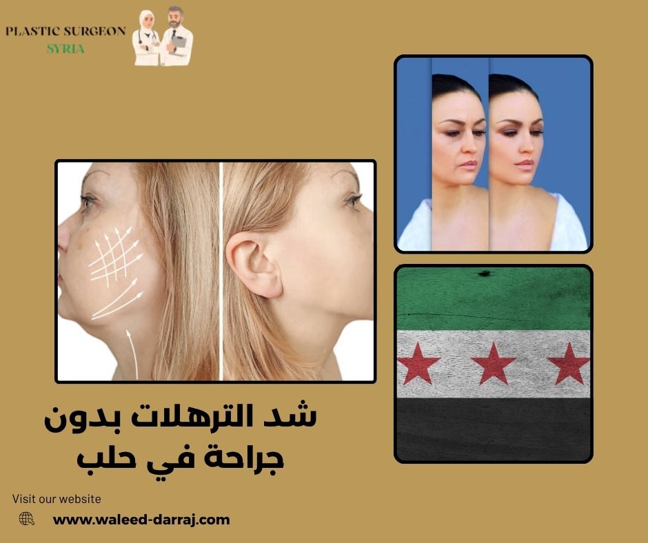 شد الترهلات بدون جراحة في حلب