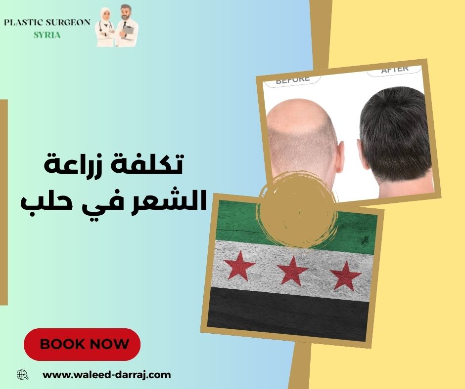 تكلفة زراعة الشعر في حلب