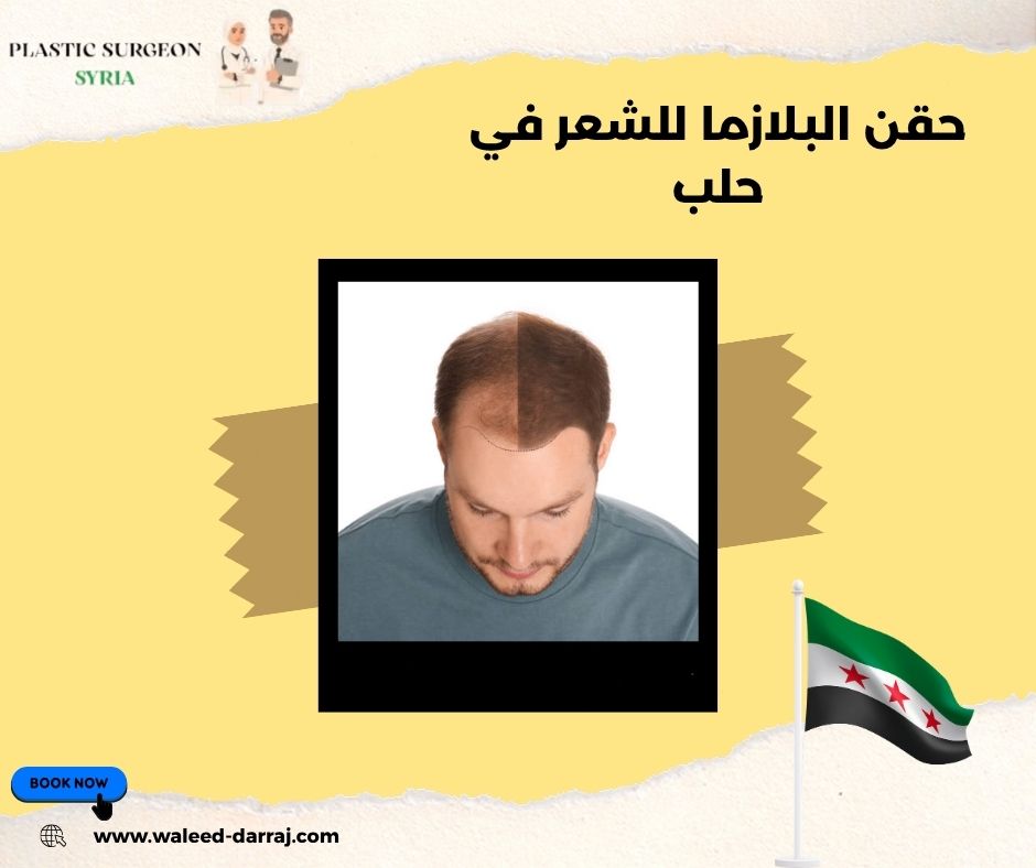 حقن البلازما للشعر في حلب