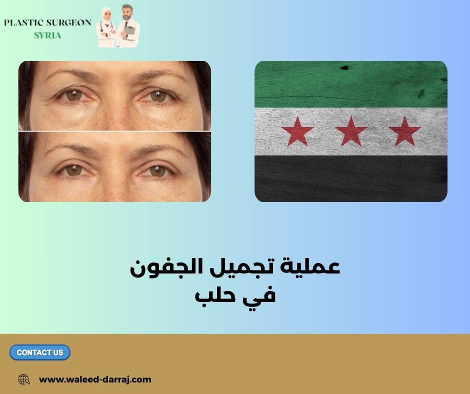 تجميل الجفون وشد العينين في حلب