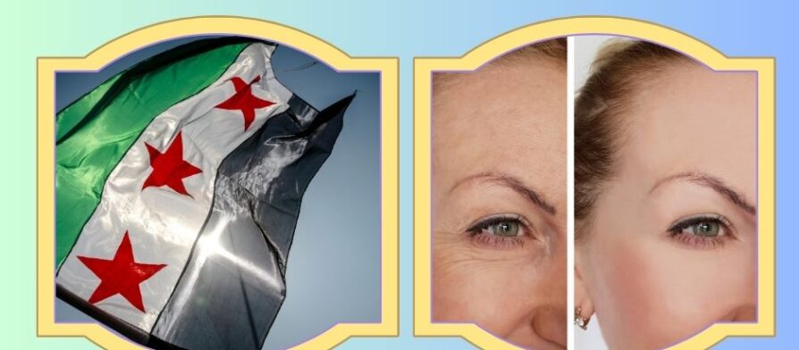 تجميل الجفون وشد العينين في حلب
