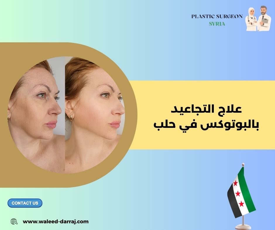 علاج التجاعيد بالبوتوكس في حلب
