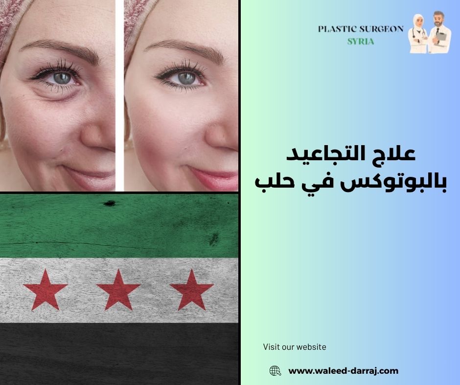 علاج التجاعيد بالبوتوكس في حلب