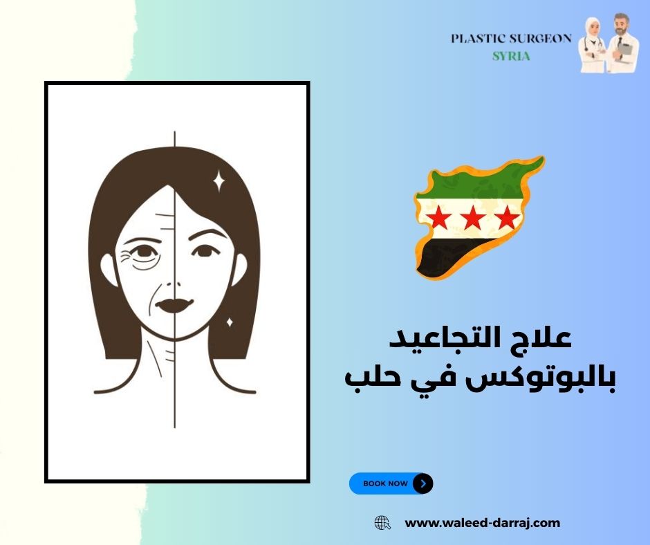 علاج التجاعيد بالبوتوكس في حلب