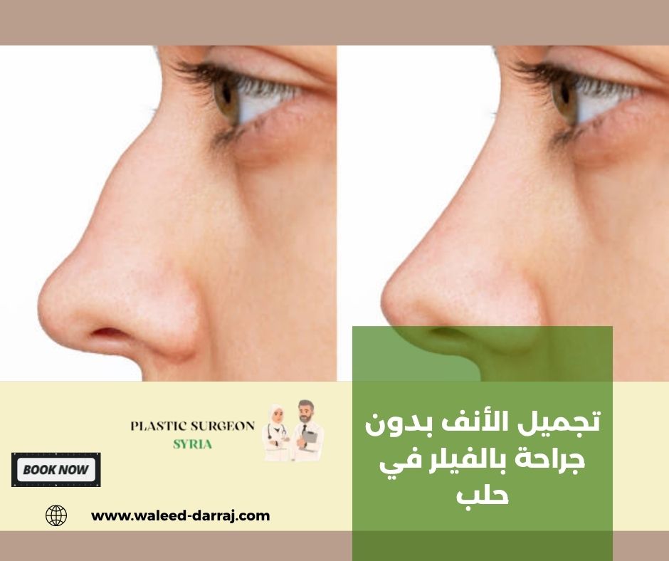 تجميل الأنف بدون جراحة بالفيلر في حلب