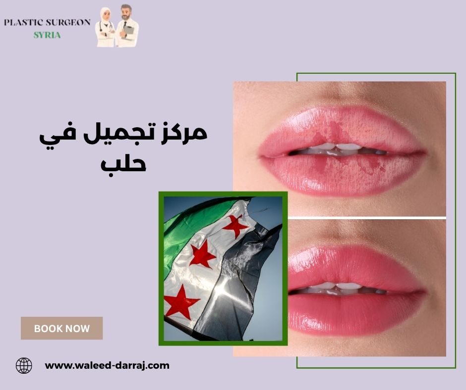 مركز تجميل في حلب