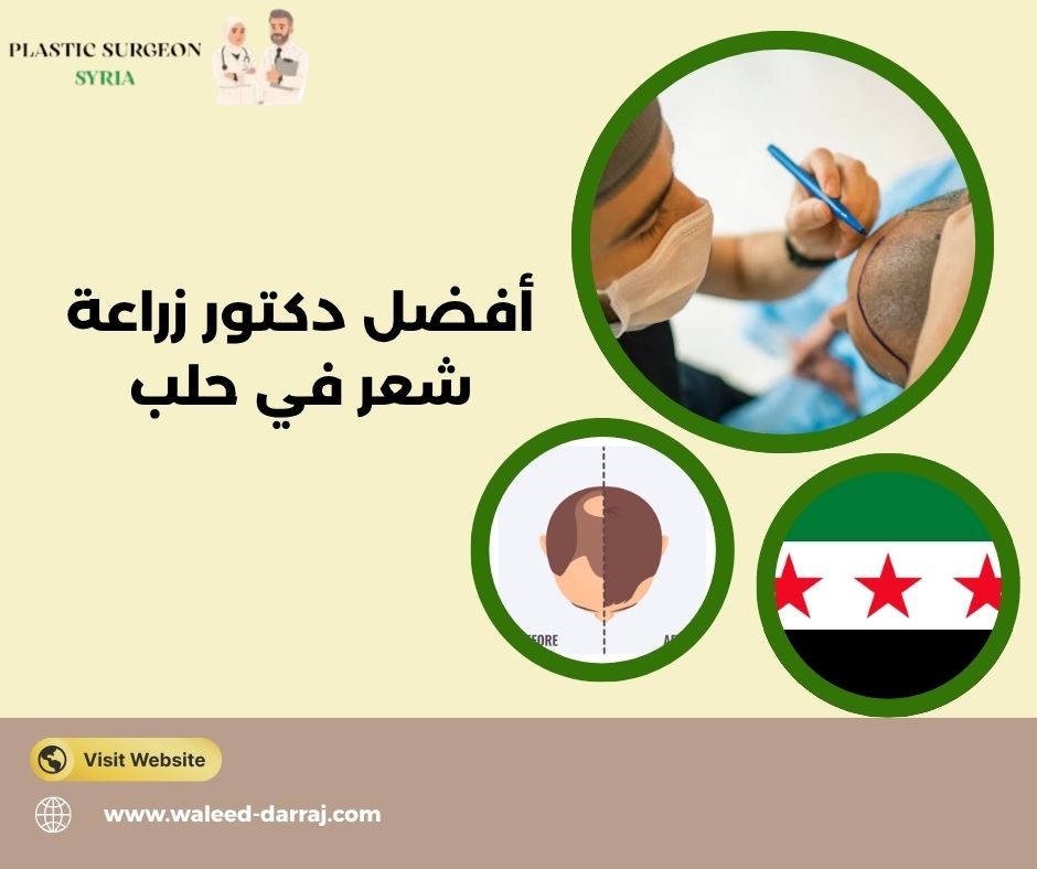 أفضل دكتور زراعة شعر في حلب