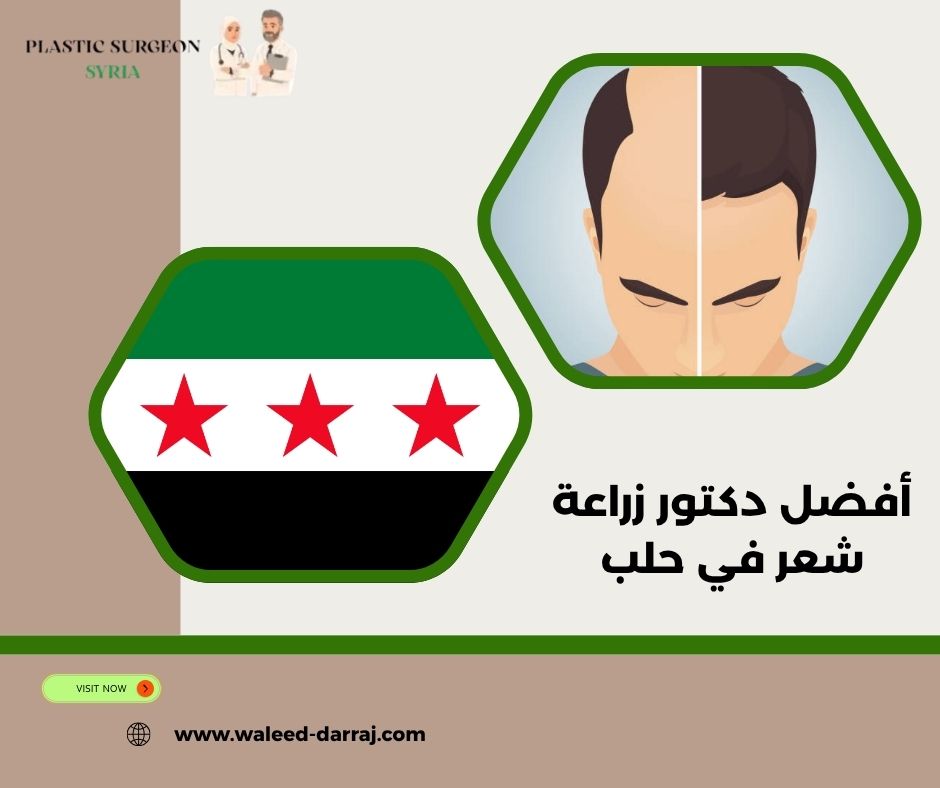 أفضل دكتور زراعة شعر في حلب