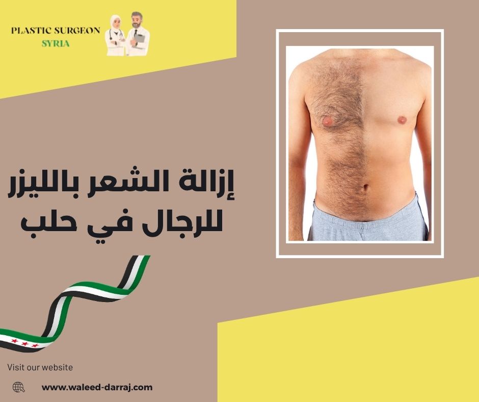 ما هي إزالة الشعر بالليزر طبياً؟