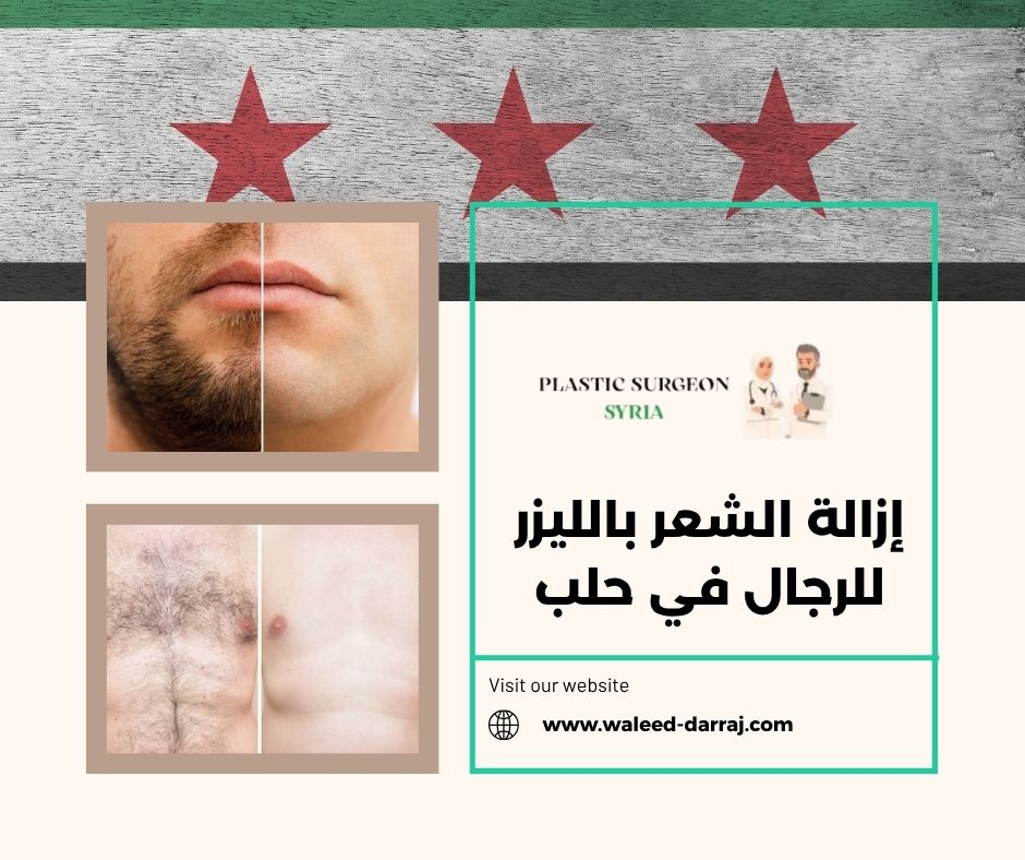 إزالة الشعر بالليزر للرجال في حلب
